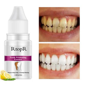 Clareador Dental 3D Perfect Whitening - RtopR®